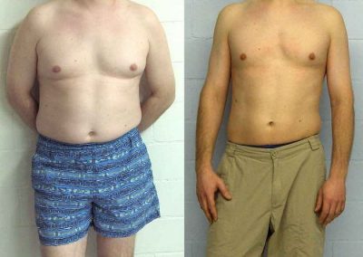 Sandor at Austin Fitness in Neerach, Switzerland, before and after