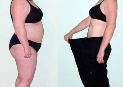 Yvonne at Austin Fitness in Neerach, Switzerland: before and after